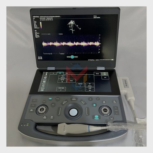 Available For Sale Mindray MX7 Ultrasound Advanced Demo (USED)