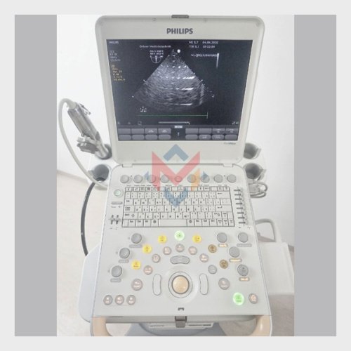 Available For Sale Philips CX50 Premium Portable Ultrasound (USED)