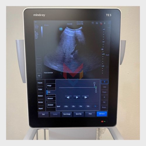 Sale! Mindray TE5 Portable Ultrasound (USED)