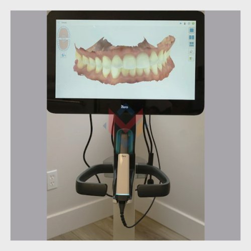 Available For Sale iTero Lumina Intraoral Scanner (USED)