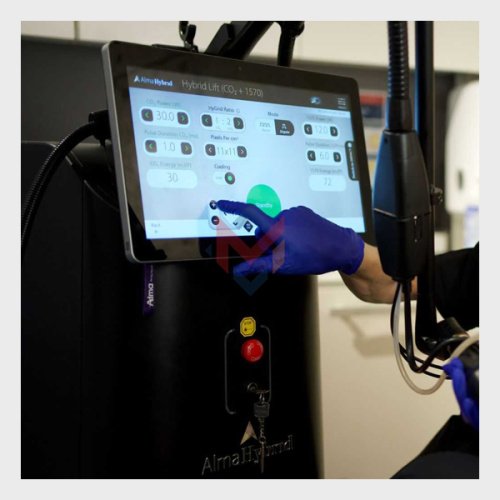 Available For Sale Alma Hybrid C02 Laser (USED)