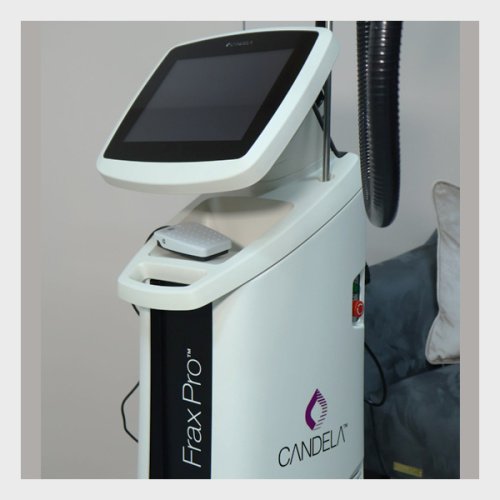 Available For Sale Candela Frax Pro Laser (USED)