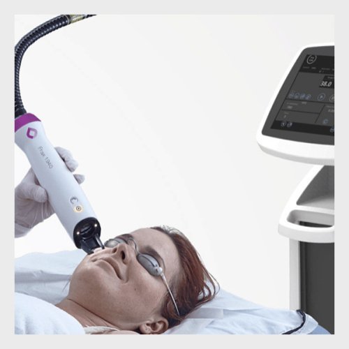 Available For Sale Candela Frax Pro Laser (USED)