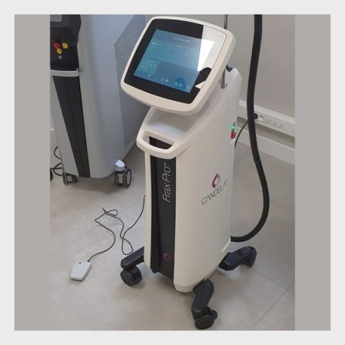 Available For Sale Candela Frax Pro Laser (USED)
