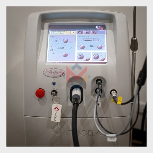 Sale! Candela Vbeam Perfecta (USED)