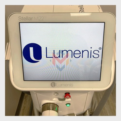 Available For Sale Lumenis Stellar M22 Laser Skin Machine (USED)